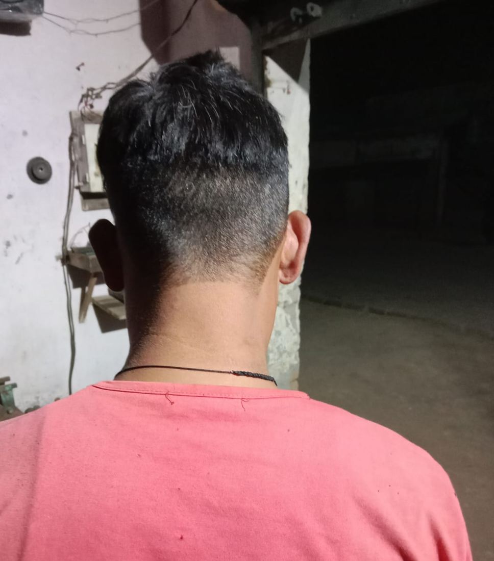 Healed scalp from behind